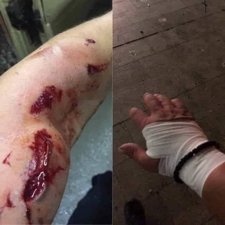 Това е ръката на полицай, пострадал при охраняването на протестите